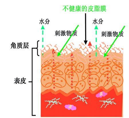 什么是敏感性肌肤,敏感皮肤?